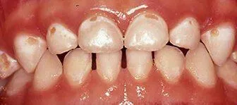 teeth
