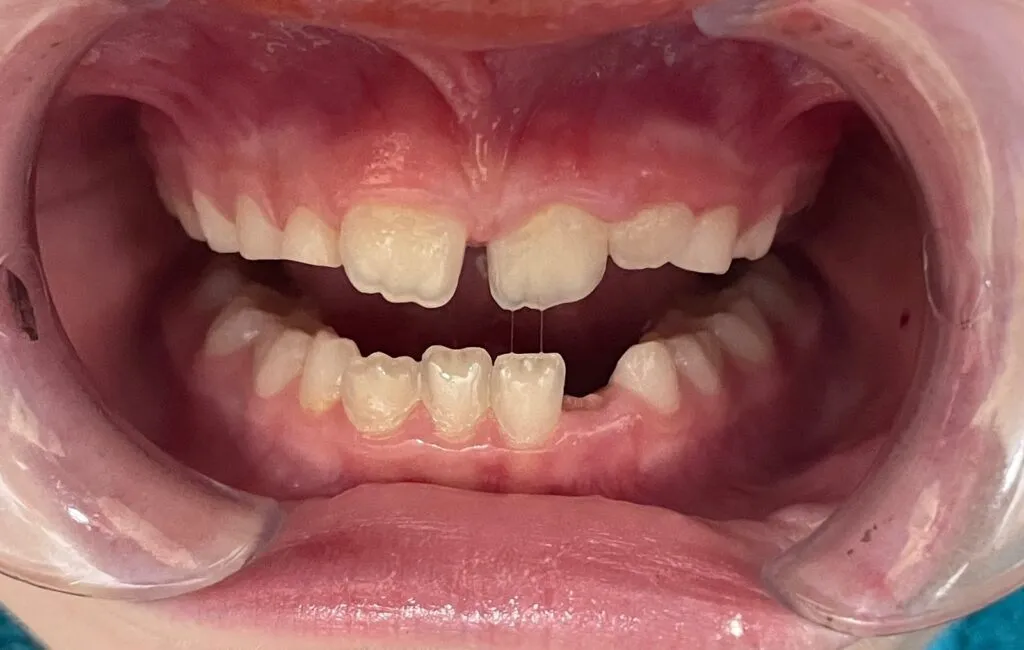 image - Pine Tree Pediatric Dentistry