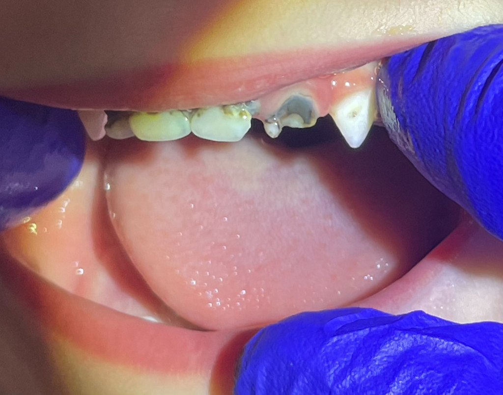 image 1 - Pine Tree Pediatric Dentistry