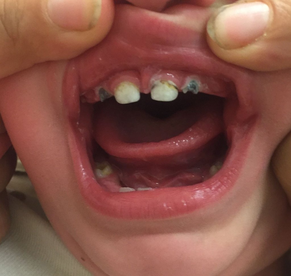 image - Pine Tree Pediatric Dentistry