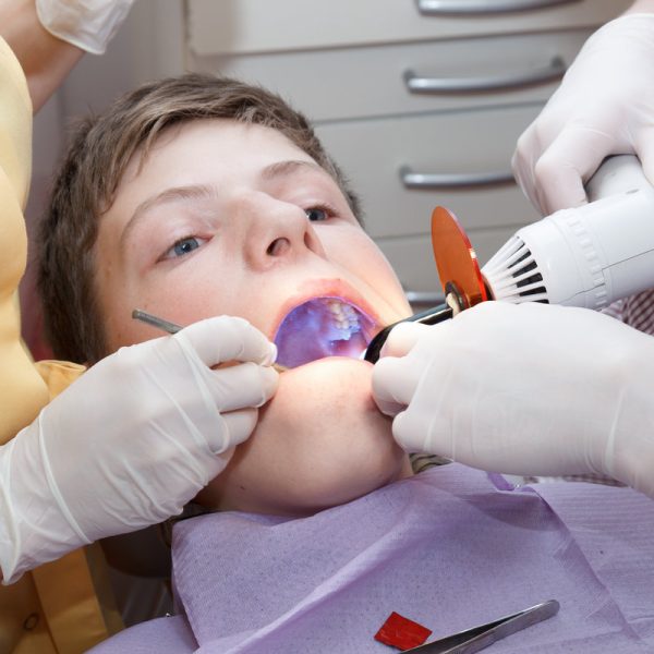 dental treatment with dental curing light